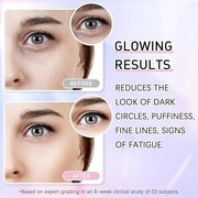 Caffeine Eye Serum Cream Kit for Dark Circles Under Eye Treatment Anti Aging For Puffiness Bags And Wrinkles 2 Fl Oz - Pro...