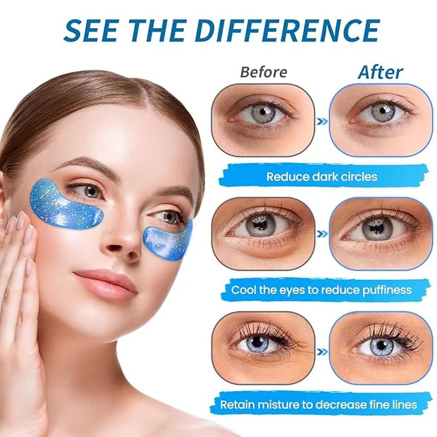Eye Gel Pads (24 Pairs) - Under Eye Patches for Puffy Eyes, Wrinkles, Dark Circles, Natural Collagen Eye Gels, Under Eye M...