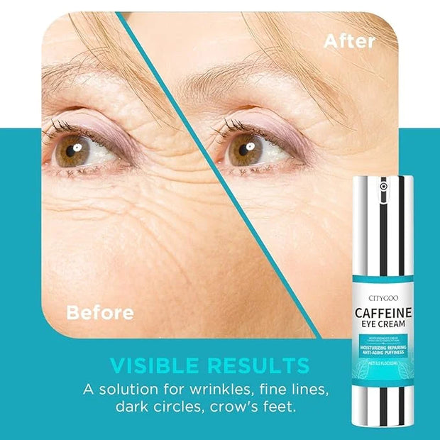 CITYGOO Caffeine Eye Cream for Puffiness: Eye Cream Reduce Dark Circles Wrinkles Fine Lines - Anti Aging Eye Cream - Produ...
