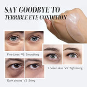 Under Eye Patches with Collagen and Peptide Eye Mask for Dark Circles and Puffiness,Face Mask Skin Care Products 30 Pairs ...