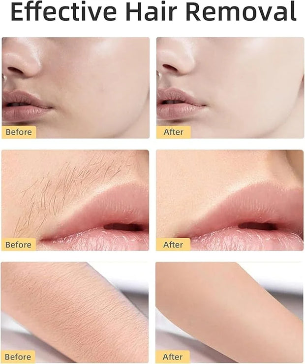 【Generation 2】Facial Hair Remover Replacement Heads for Finishing Touch Flawless Facial Hair Remover, Replacement Blades f...
