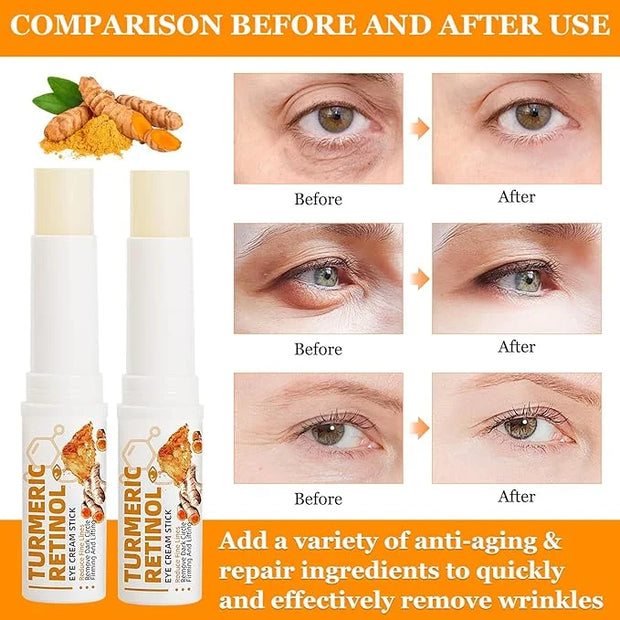2PCS Eye Bags,Eye Balm Stick Wrinkles,Hydrating for Dark Circle,For Puffiness and Bags Reduces Fine Lines - Product Image