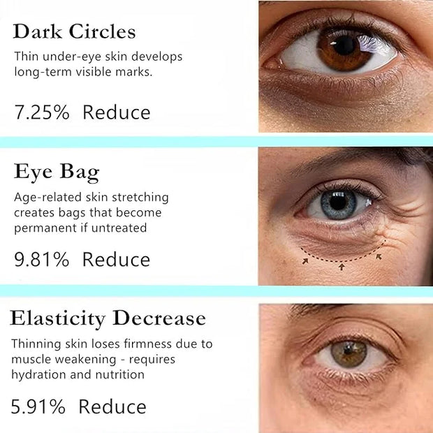 Retinol Eye Stick Balm, Retinol Eye Cream – Anti-Aging Formula Reduces Fine Lines, Dark Circles & Puffiness, Hydrates Deli...