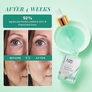 Squalane Retinol Jojoba Oil Moisturizer for Face Hydrate, Nourish, Moisturize Fine Lines and Wrinkles, Wrinkle-Repair Faci...