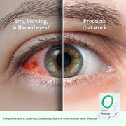 Rescue: Hydrogel Self Cooling Compress | Cold Eye Masks for Puffy Eyes | Self Cooling Eye Compress for Fast Relief | Trave...