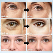 Under Eye Masks 60PCS – Retinol & Collagen Eye Patches for Dark Circles and Puffiness, Hydrating Cooling Under Eye Pads fo...