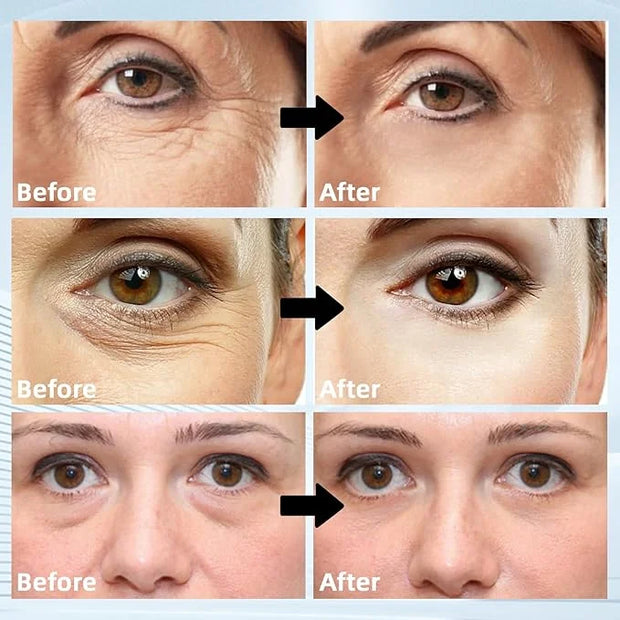 Under Eye Masks 60PCS – Retinol & Collagen Eye Patches for Dark Circles and Puffiness, Hydrating Cooling Under Eye Pads fo...