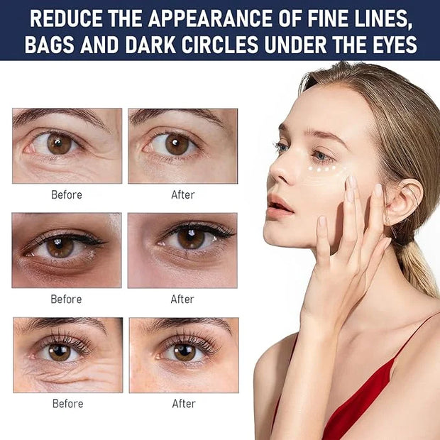 Rapid Reduction Eye Serum, Advanced Formula Instant Eye Serum, Anti Aging Serum Visibly Reduces Under-eye Bags, Nourishing...