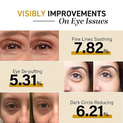 CITYGOO Eye Cream For Dark Circles: Eye Puffiness Under Eye Bags Treatment - Anti-Wrinkle (Snail Eye Stick 1 Count) - Prod...