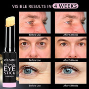 VELAMO ADVANCED Retinol Eye Stick: Retinol Eye Cream for Dark Circles and Puffiness with 1% Bakuchiol and Caffeine - Visib...