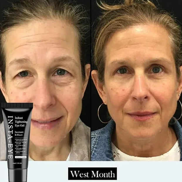 Instant Eye Tightener Cream,Under Eye Tightening Cream for Firm and Smooth the Look of Fine Lines,Reduces Dark Circles, Ba...