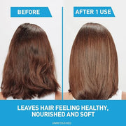 CeraVe Hydrating Anti Dandruff Conditioner, 0.5% Pyrithione Zinc Dandruff Treatment With Ceramides, Hyaluronic Acid & Niac...