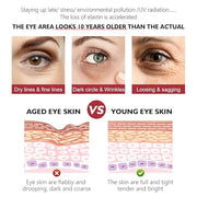 Retinol Eye Cream, Anti-Aging with Vitamin C & Ceramide for Dark Circles, Wrinkles & Fine Lines, Crow’s Feet, 0.7 fl.oz - ...
