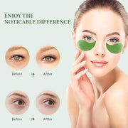 Under Eye Patches, 30 Pairs Aloe Vera Eye Mask for Dark Circles, Puffy Eyes, Wrinkles,Skincare for Women & Men - Product I...