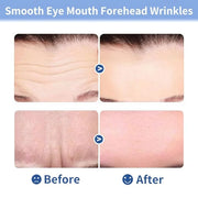 10pcs Masks | Collagen Forehead Anti-Wrinkle Treatments | Jelly Touch Mask | Skin-Friendly Hydrogel for Deep Hydration, Fi...