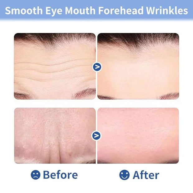 10pcs Masks | Collagen Forehead Anti-Wrinkle Treatments | Jelly Touch Mask | Skin-Friendly Hydrogel for Deep Hydration, Fi...
