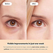 LE GUSHE K-BEAUTY Pimple Patches for Face (132 dots) & Under Eye Patches (30 Pairs). Gold Eye Mask with Collagen & Amino A...