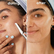 Gillette Venus Dermaplaning Tool, 2 Blade Refills, Exfoliating Face Razors for Women, Eyebrow and Facial Dermaplane Razor ...