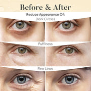 Vitamin C Under Eye Patches (30 Pairs), Under Eye Mask for Puffy Eyes, Appearance of Dark Circles, Smoothing & Hydration, ...