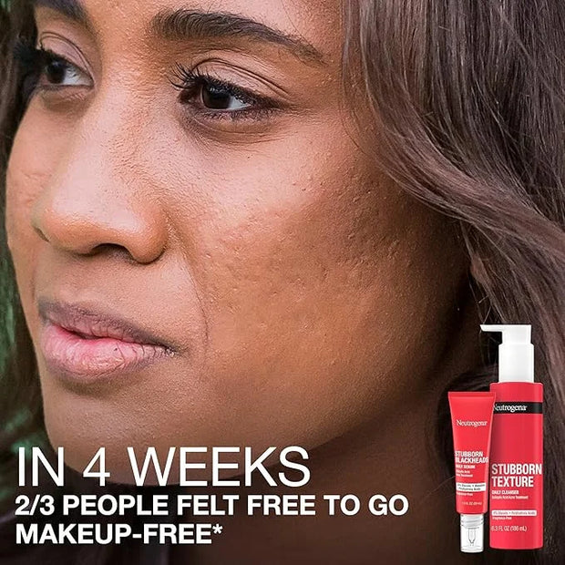 Neutrogena Stubborn Blackheads Daily Acne Facial Serum with Salicylic, Glycolic, Polyhydroxy & Mandelic Acids, Oil-Free Fa...