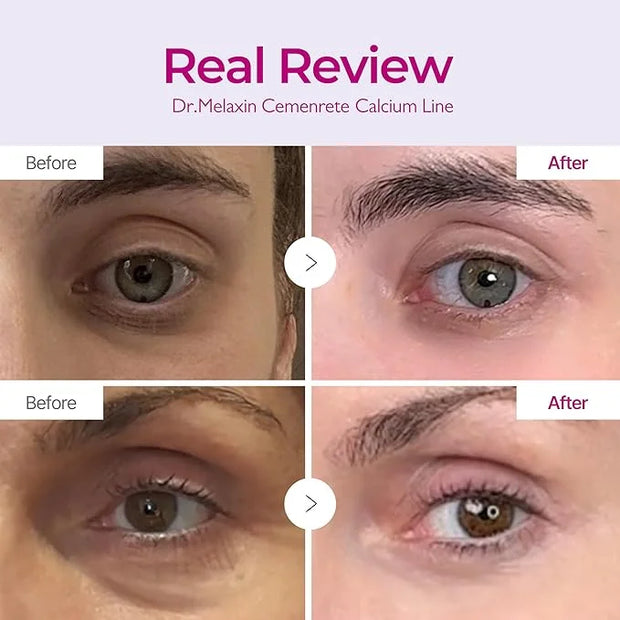CEMENRETE EYE CREAM - Product Image