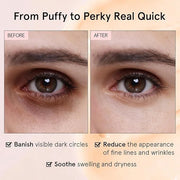 grace & stella Under Eye Cream for Dark Circles - Caffeine Eye Cream Anti Aging for Wrinkles - For Undereye Brightening, P...