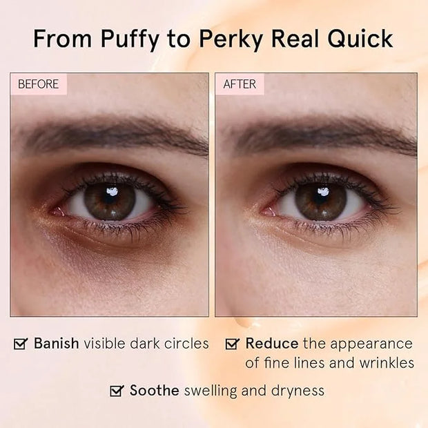 grace & stella Under Eye Cream for Dark Circles - Caffeine Eye Cream Anti Aging for Wrinkles - For Undereye Brightening, P...