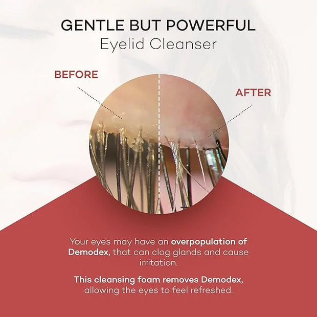 ZocuFoam Eyelid Cleanser - Foaming Eyelid Scrub - Natural pH Balanced Solution - 25mL - Product Image