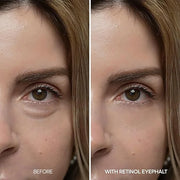 Retinol Eyebag Cream for Puffiness, Dark Circles & Fine Lines, Wrinkle, EGF Anti-Aging Under Eye Moisturizer with Niacinam...