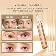 Eye Cream for Dark Circles: Under Eye Cream with Caffeine Retinol - Reduces Under Eye Bags and Fine Lines Gold - Product I...