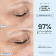 NuFACE FIX Line Smoothing Starter Kit - FDA Cleared Microcurrent Device + Serum Activator for On-The-Go Treatment of Foreh...