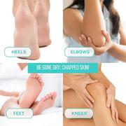 Onyx Professional Cracked Heel Repair Balm Stick for Dry Cracked Feet Treatment, Tea Tree Scent, 2 pack - Moisturizing Foo...