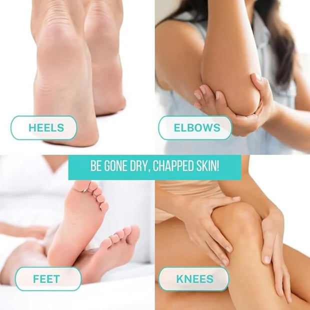 Onyx Professional Cracked Heel Repair Balm Stick for Dry Cracked Feet Treatment, Tea Tree Scent, 2 pack - Moisturizing Foo...