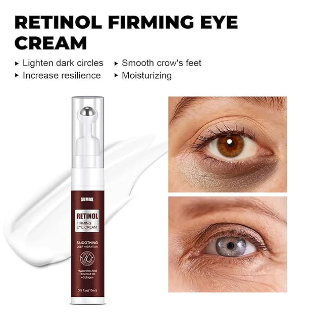 Advanced Retinol Eye Cream With Hyaluronic Acid,Coconut Oil and Collagen,Under Eye Cream for Dark Circles, Reduces Puffine...