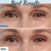 Natural Eye Cream- 26Pcs DIY Eye Cream Making Kit, Under Eye Cream for Wrinkles and Bags Skin Care Treatment with Vitamin ...