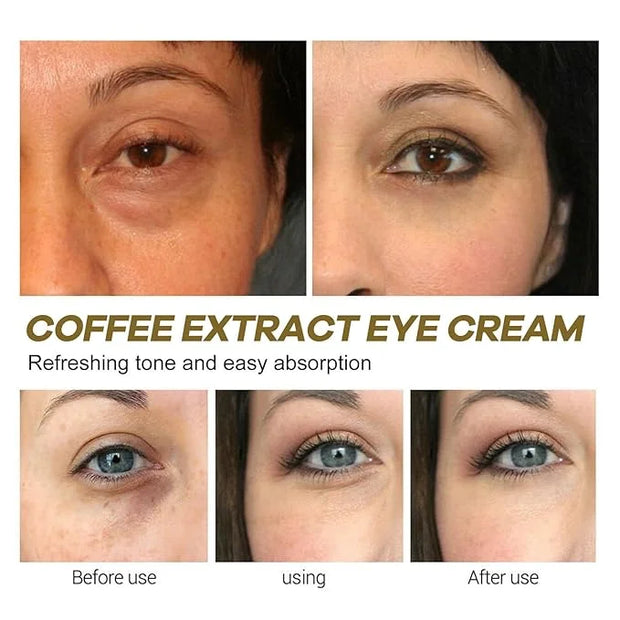 2Pcs Caffeine Eye Cream, Caffeine Eye Cream For Dark Circles And Puffiness, Korean Retinol Fix Eye Cream For Tightening An...
