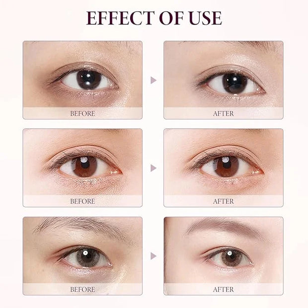 2PCS Mango Eye Cream, Eye Moisturizing Serum, Anti-Aging Treatment for Puffiness, Dark Circles & Fine Lines, Fast-Absorbin...
